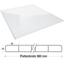 Terrassendach Komplettset mit ECO Verlegeprofil Stegplatte Polycarbonat 16 mm UV Controll